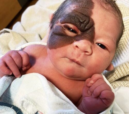 Родителите са смаяни, когато виждат новородената си дъщеря за първи път, но ето как изглежда тя сега