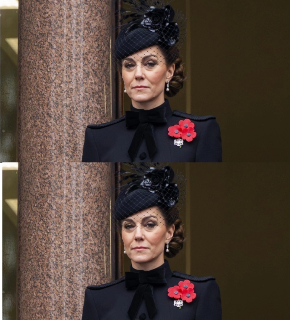 Тежко състояние: Експерт по четене по устните разчете таен разговор на Кейт, всички са в шок