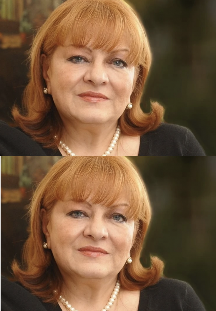 Оперираха Богдана Карадочева