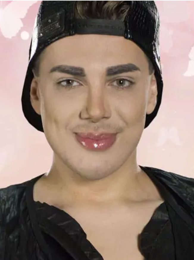 Пребиха Валентин Кулагин: Целият е в пирони (СНИМКА)