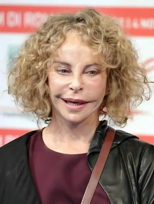 Някога тя беше любимка на милиони благодарение на необичайния си външен вид, но опита да запази младостта си ,изигра лоша шега