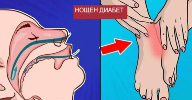 7 симптома на НОЩЕН ДИАБЕТ, които не трябва да игнорирате: Повечето хора не предполагат, че причината е това!