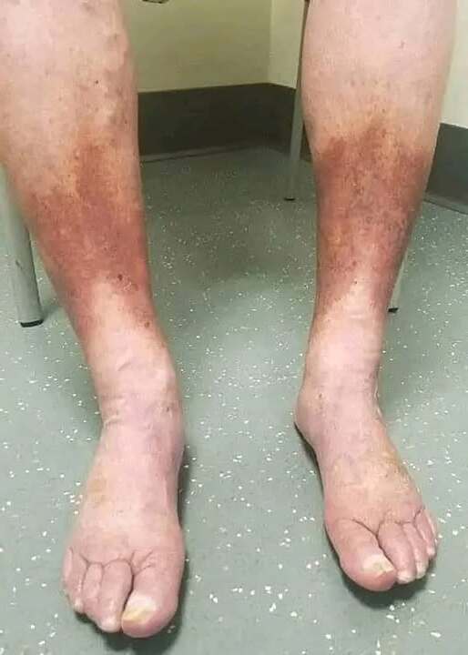 524895224 638601542610870 100676 1