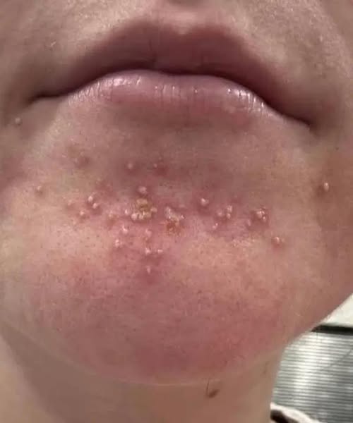 Това са последиците от спането с…