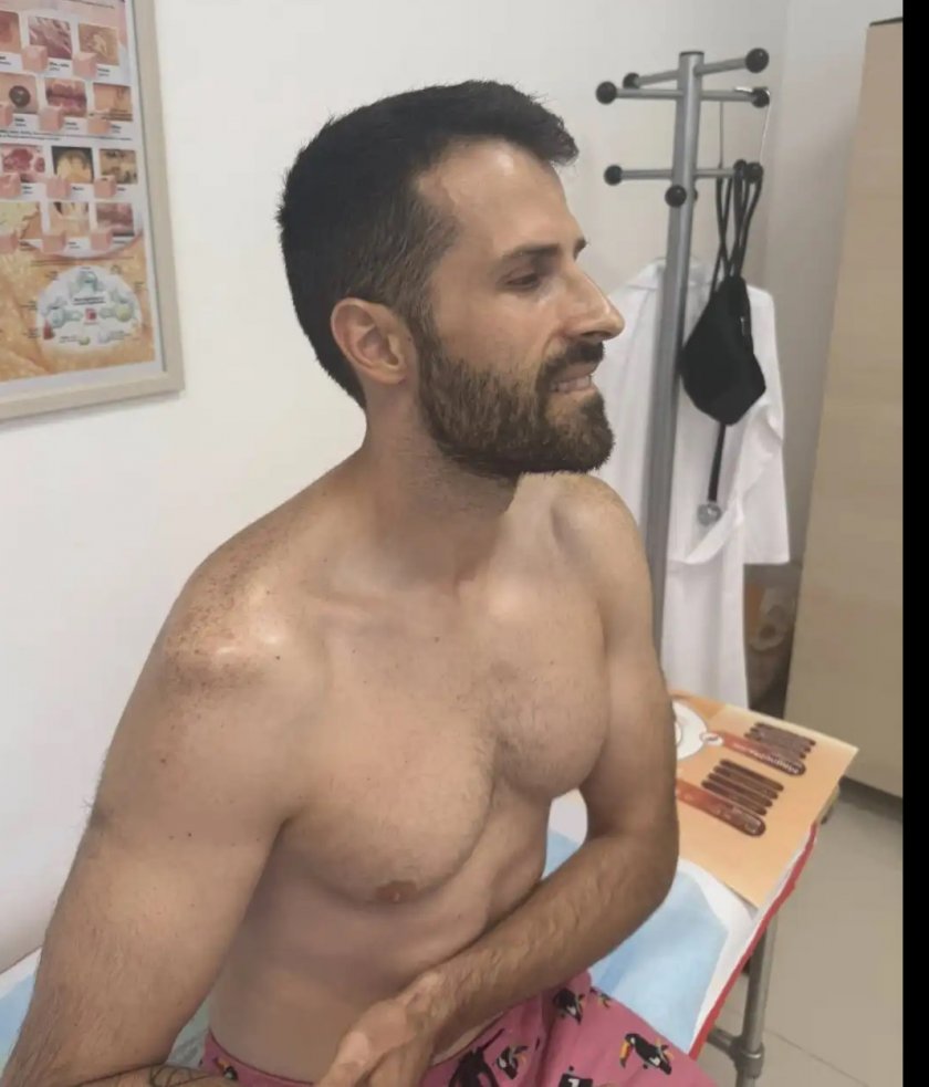 Георги Блажев се осакати на аквапарк в Несебър (снимки)