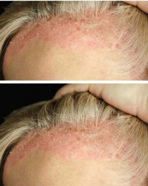 Това са последствията от къпането с…