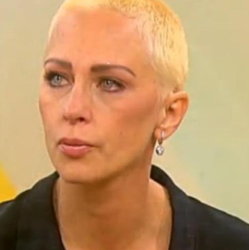 Нана Гладуиш сподели плашещи снимки от лицето си