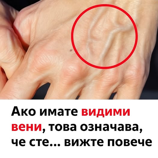 Ако имате видими вени, това означава, че сте…