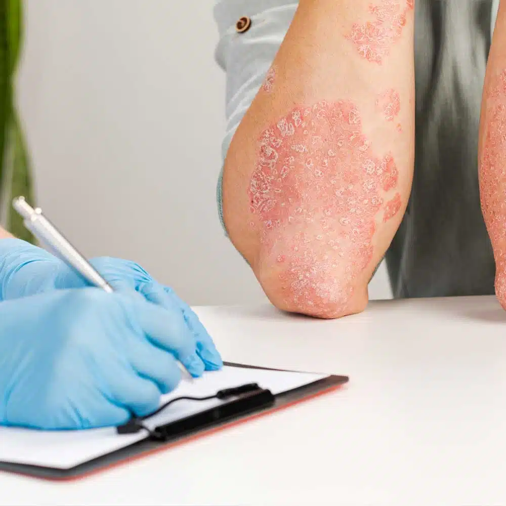 zona apres 65 ans.jpg