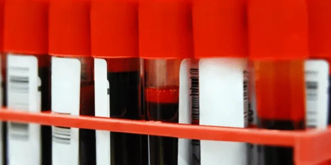 Хората с кръвна група О имат по-малък риск от инфаркт и високо кръвно налягане. Вижте кои предимства и недостатъци крият останалите групи!