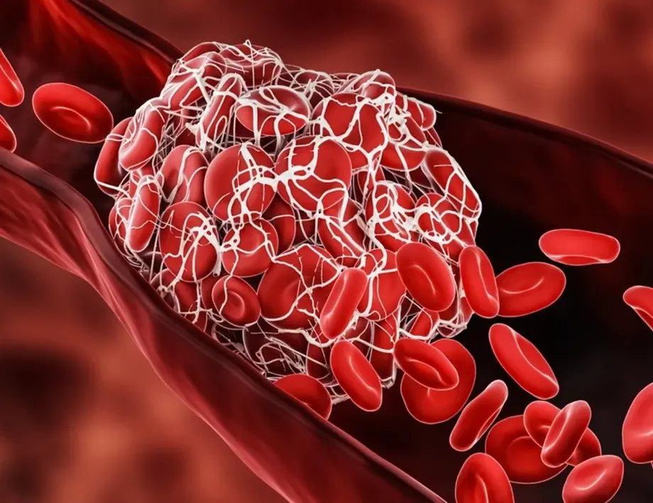 Това е подправка №1 за сваляне на захарта и холестерола