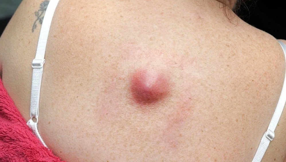 555069347 805097005429781 430640