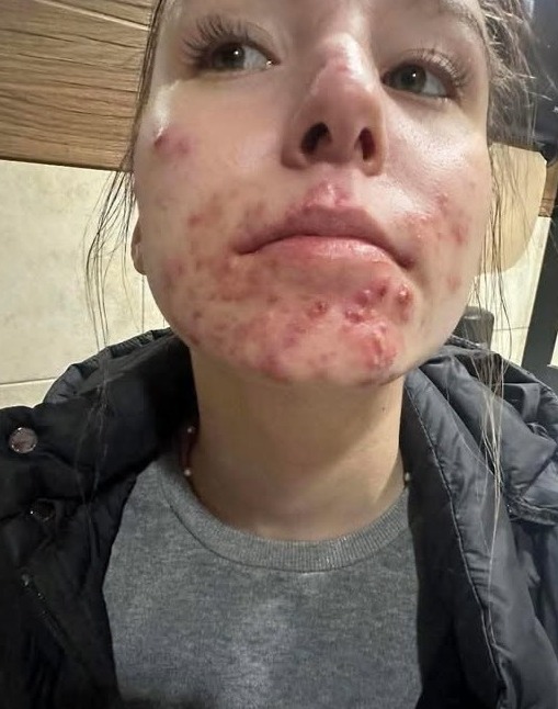 Ето какви са последиците от съня с… Вижте повече