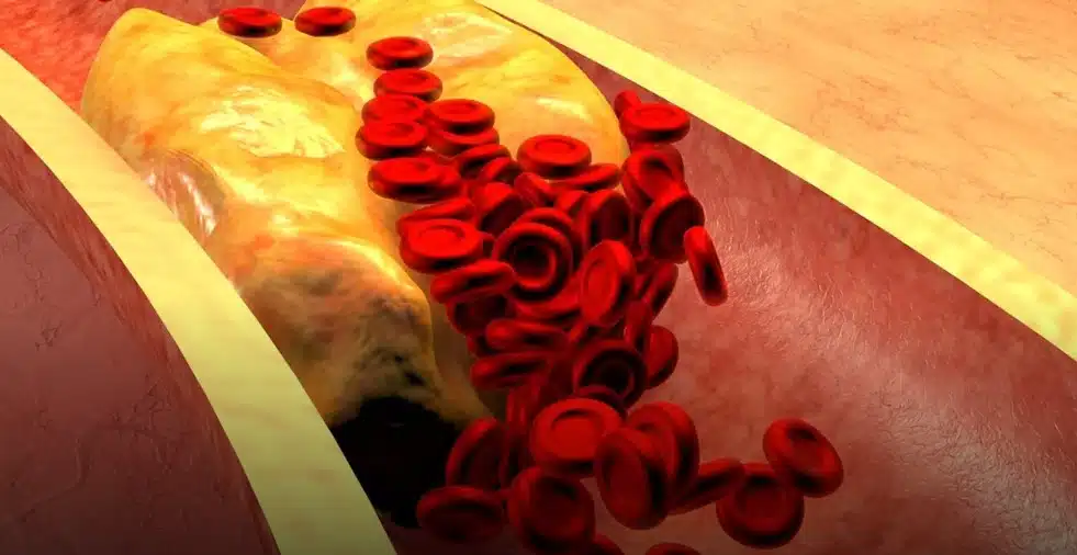 Ето кой плод сваля кръвното и холестерола без никакъв проблем