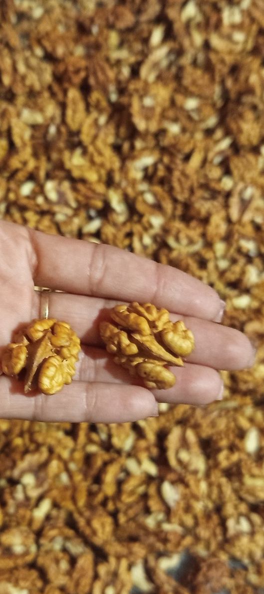 Лекарите разкриват, че яденето на ОРЕХИ причинява…