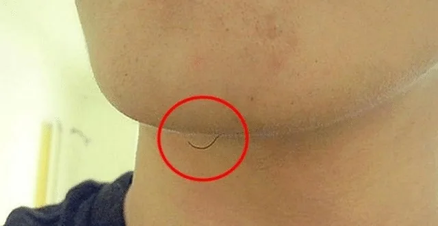 Ако имате косми по брадичката: Ето какво наистина означава това: