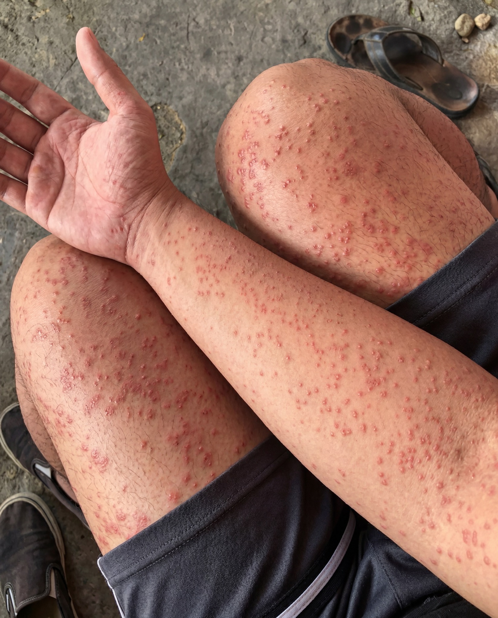 677249634 857268477410841 854517