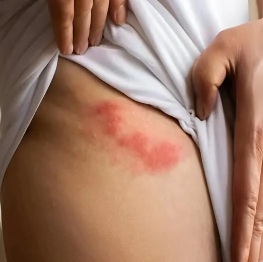 ВНИМАНИЕ: Ето коя е причината за това рядко кожно заболяване…