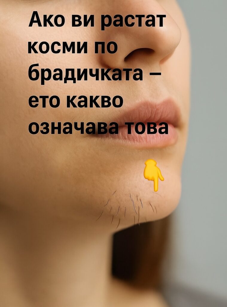 Ако на брадичката ви се появяват тъмни косъмчета, това може да е знак, че сте…